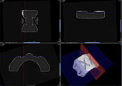 X線CTスキャン撮影では一発 スキャンで正確に3Dデータ化することができます。